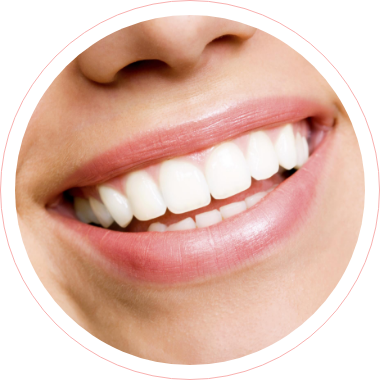 Service 8 - Teeth Whitening